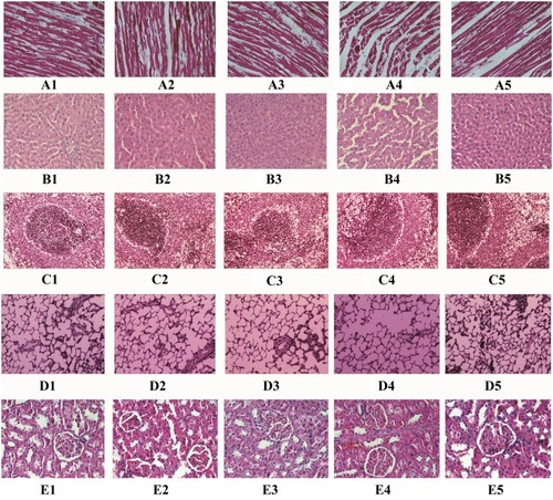 Figure 7 Representative images of HE staining results from (A) heart, (B) liver, (C) spleen, (D) lung, and (E) kidney with 1) control group (0mg); 2) p(AAPBA-b-NVCL)1 group (10mg); 3) p(AAPBA-b-NVCL)2 group (10mg); 4) p(AAPBA-b-NVCL)3 group (10mg); and 5) p(AAPBA-b-NVCL)4 group (10mg).