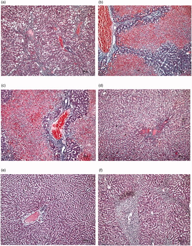Figure 5. Histological profiles of liver cells in 6 rat cohorts with 10× magnification in focus assay: (a) healthy control; (b) hepatotoxic control showed massive inflammation liver cells; (c) silymarin control at 200 mg/kg indicated inflammation liver cells; (d) P. odoratissimus extract of 300 mg/kg; (e) P. odoratissimus extract of 600 mg/kg; (f) P. odoratissimus extract of 900 mg/kg. Subfigures (d)–(f) demonstrated the healing of liver cells after the extract treatments towards paracetamol intoxication.