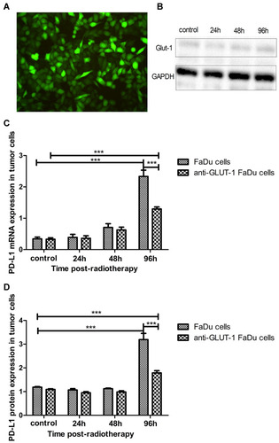Figure 5 PD-L1 expression before and after RT in siRNA-GLUT1 FaDu cells. (A) Transfection efficiency of GLUT1 siRNA by fluorescence analysis. (B) GLUT1 protein expression in siRNA-GLUT1 FaDu cells before and after RT. (C, D) PD-L1 mRNA and protein expression in siRNA-GLUT1 FaDu cells was significantly decreased at 96 h after RT compared with that recorded in FaDu cells, as presented by the two-way analysis of variance (p<0.001 and p<0.001, respectively). (***p<0.001).