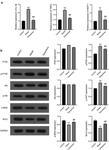 Figure 11. (a) The expression levels of IL-6, TNFα and MCP-1 in the kidney tissues were examined by qRT-PCR in control, model and tetrandrine groups rats. (b) The expression of p-PI3K, PI3K, Akt, p-Akt, p-BAD, Bcl-2 were examined by western blot in control, model and tetrandrine groups rats. **, P < 0.01 vs. control group; ##, P < 0.01 vs. model group