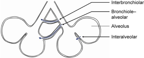 Figure 1 Three different pathways for collateral ventilation.