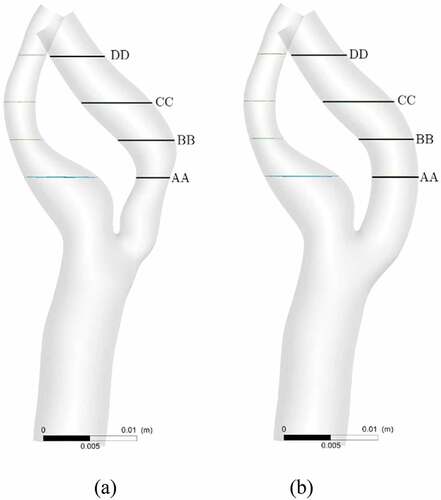 Figure 6. Locations of four slice planes inserted into ICA for velocity analysis; (a) stenosed model, (b) stented model.