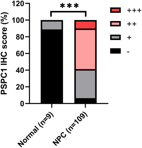 Figure 2 Percentage distribution of PSPC1 IHC score in NPC tissues versus normal tissues.