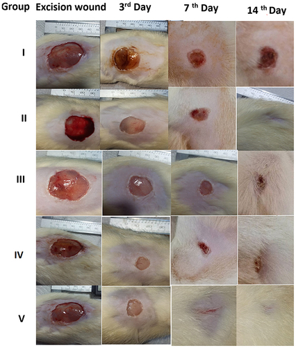 Figure 11 Comparison of the wound-healing activity of group I (untreated), group II (Mebo +Gentamycin), group III (treated with Althea Officinalis), and group IV (treated with A.O.–ZnO -NPs) and group V (A.O.-ZnO-NPs-Cs) at 3rd,7th and 14th.