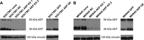 Figure 2 The analysis of survival time according to AEP expression.