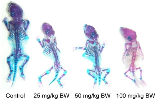 Figure 1 Maternal exposure to nano-TiO2 induced dysplasia of skeleton in mice embryos at gestational day 18.Notes: Blue indicates cartilage. Purplish red indicates ossification. Red indicates incomplete ossification.Abbreviations: nano-TiO2, nanoscale titanium dioxide; BW, body weight.