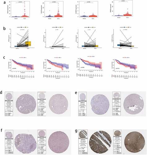 Figure 12. The expression of four key genes in hepatocellular carcinoma (HCC) and their survival status. (a) the expression levels of the four key genes in HCC tissues and normal tissues. (b) the expression levels of four key genes in paired HCC tissues and adjacent tissues. (c) the survival status of high and low expression groups of the four genes. protein expression levels of the four genes in HCC and adjacent tissues. (d) CXCL5, (e) CXCL8, (f) IL18RAP, (g) and TREM2