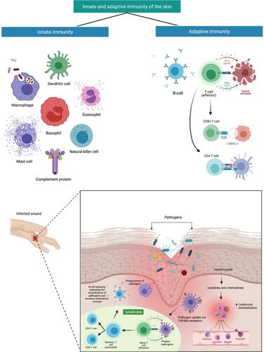 Figure 2 Innate and acquired immune systems interactions in cutaneous bacterial infection. Disruption in the aforementioned barrier leads directly to occasional infections. In reaction to bacteria infringing the epithelial barrier, keratinocytes will produce chemokines, antimicrobial peptides, and cytokine,s which leads to an increase in leukocyte extravasation stimulating the migration into the skin and guiding these cells via chemotactic gradients. Dendritic cells convey bacterial antigens to naïve and central T-cells, contributing to pathogen-specific cells being activated producing CD4 and CD8 T-cells which increased targeting of innate responses. Created with BioRender.com.