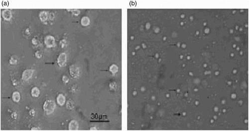 Figure 1. Morphology of PAMs (a) and IMs (b) under light microscopy. PAMs or IMs are pointed by arrows. Magnification: 40×; scale bars: 30 μm.