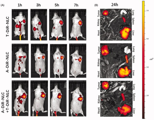 Figure 4. (A) In vivo tumor targeting effect of T-Dir-NLC, A-Dir-NLC, and combined A-Dir-NLC + T-Dir-NLC. Tumors were showed in the right armpit of the mice in the pictures. (B) Ex vivo fluorescent pictures of T-Dir-NLC, A-Dir-NLC, and combined A-Dir-NLC + T-Dir-NLC in tumors and normal tissues of the mice.