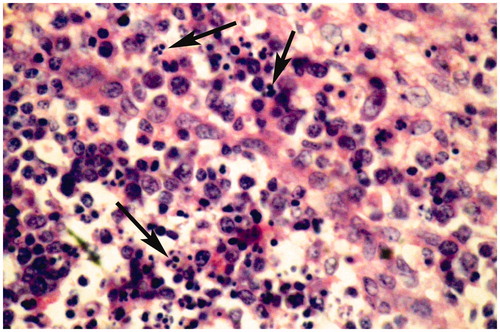 Figure 3. Bursa of Fabricius of broiler chick administered chlorpyrifos (20 mg/kg BW) at post-treatment Day 15. Representative photomicrograph shows fragmentation of nuclei (apoptotic changes) in lymphoid follicle (arrows). H&E stain. Magnification = 400×.