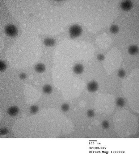 Figure 5 The TEM image of DHPS nanoemulsion particles.