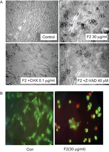 Figure 3.  Effect of F2 on observation of microscopy changes in U-87 cells. (A) Effect of cycloheximide/Z-VAD-FMK on F2-induced cell vacuolization. Cells were exposed to F2 (30 μg/mL) for 24 h with or without cycloheximide (CHX; 0.1 μg/mL) or Z-VAD-FMK (Z-VAD; 40 μM), and analyzed by light microscopy. (B) Fluorescence microscopy changes in U-87 cells. Cells were treated with or without F2 (30 μg/mL) for 24 h and AO/EB staining was performed. AO is taken up by both viable and nonviable cells and emits green fluorescence if intercalated into DNA. EB is taken up only by nonviable cells and emits red fluorescence by intercalation into DNA. Results are from a single experiment; similar results were obtained in three separate experiments.