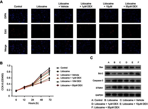 Figure S1 DEX restores the impaired proliferation and apoptosis by lidocaine in primary neuronal cells. (A) The effect of DEX on cell proliferation was detected by EdU staining assay. (B) The effect of DEX on cell viability in lidocaine-treated cells. Cell viability at the indicated time points was detected by CCK8 assay. (C) The expression of Bax, Bcl-2, caspase-3 and caspase-9 in lidocaine or lidocaine/DEX combination treated cells was analyzed by Western blotting.