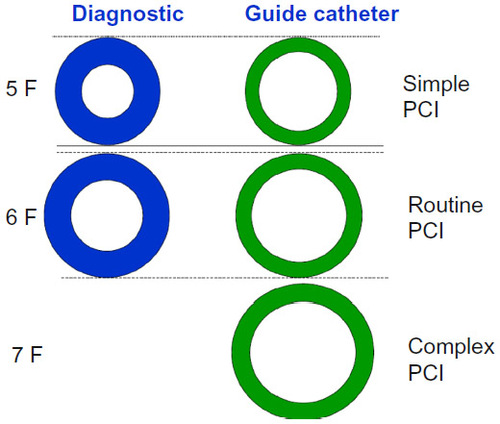 Figure 4 Illustration showing the relative sizes of diagnostic and guide catheters and preferred cases for simple, routine, and complex PCIs.