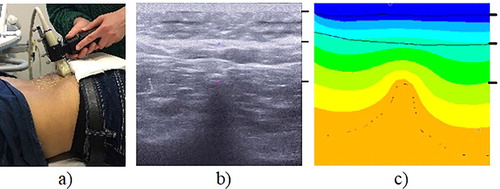 Figure 1. (a) Experimental set up. (b) Ultrasound data. (c) Example of simulation result. For (b) and (c): above 1st black right-side dash – skin; above 2nd – fat; below 2nd – muscle and bone; 3rd dash – top apex of the bone.