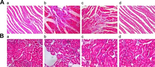 Figure 1 Hematoxylin and eosin staining of heart and kidney tissues in rats.