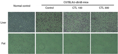 Fig. 2 Representative images of histological observation in the liver and the fat of C57BL/6J-db/db mice with dietary supplementation of Cudrania tricuspidata water extract.