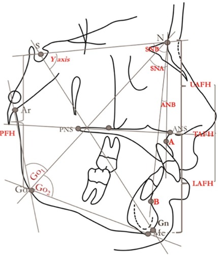 Figure 1 Anatomical landmarks used in this research.