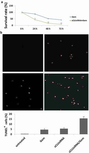 Figure 4. Effect of sCLU knockdown combined with Gem treatment on apoptosis and viability of KHOS cells. (a), KHOS cells were transfected with sCLU or control siRNA with or without Gem treatment (1–20 μg/ml) for 48 h; cell viability was detected with the MTT assay. (b), KHOS cells were transfected with sCLU or control siRNA with or without Gem treatment (10 μg/ml) for 48 h; cell apoptosis was detected with the TUNEL assay. *P < 0.05, **P < 0.01.