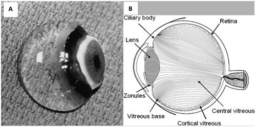Figure 1. (A) Human vitreous of a 9-month-old child dissected of the sclera, choroid, and retina, is still attached to the anterior segment, Reprinted by permission from Springer: Eye,Citation18 Imaging vitreous. Sebag et al. (2002), (B) Orientation of collagen fibres in the vitreous humour, reprinted by permission from (Springer), Eye,Citation19 adult vitreous structure and postnatal changes. Le Goff MM, Bishop PN. Eye (2008) 22.