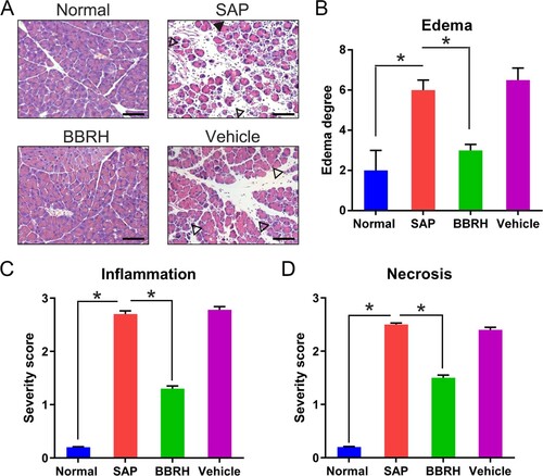 Figure 1. Effects of BBRH on the histology of the pancreas in SAP. The pancreas was cut 24 h after SAP modeling. (A) Representative HE staining and (B) histological extent of edema are displayed. Scale bar, 50 µm. Result is presented in the form of mean ± SD (n = 15 per group). Differences among various groups are assessed using ANOVA. *P < 0.05.