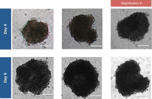 Figure 1 Microscopic images of human ovarian adenocarcinoma (SKOV-3) multicellular spheroids formed by the hanging drop method and harvested on days 4 and 6 after initiation of spheroid formation.Notes: The scale bars correspond to 200 µm.