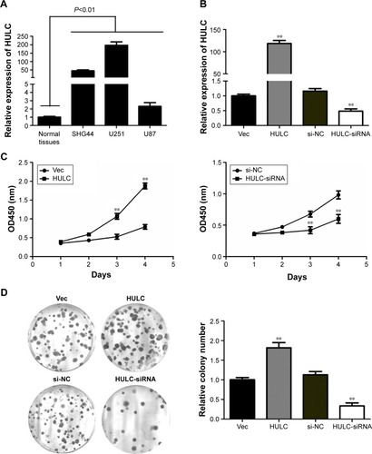 Figure 2 The level of HULC expression in glioma cells and its effect on cell growth in vitro.