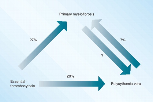 Figure 6. The inter-relationship between chronic myeloproliferative disorders.Schematic diagram illustrating the evolution of phenotype in the chronic myeloproliferative disorders (MPD). For unexplained reasons, both polycythemia vera and primary myelofibrosis can present as isolated thrombocytosis. Therefore, essential thrombocytosis has no phenotype and patients with isolated thrombocytosis should be followed carefully for evolution into another MPD. All pathways converge on polycythemia vera because that disorder is the ultimate expression of JAK2 V617F.