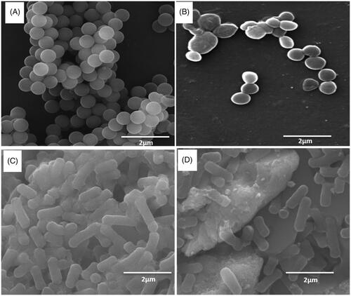 Figure 10. SEM images (A) Untreated S. aureus (B) ZnO NPs treated S. aureus, (C) Untreated E. coli (D) ZnO NPs treated E. coli.