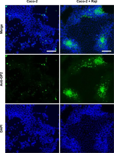 Figure 8 Immunocytochemical analysis of M-cell characters in Caco-2 and Raji co-culture.Notes: Cells were exposed to anti-GP2 antibody after differentiation process and stained with fluorescent secondary antibody. Microscopic images were taken through Axio Imager 2. DAPI (in blue) indicated the cell nucleus, and the cells those have developed M-cell-like characteristics were stained with GP2 antibody (green).Abbreviations: DAPI, 4′,6-diamidino-2-phenylindole; GP2, glycoprotein 2.