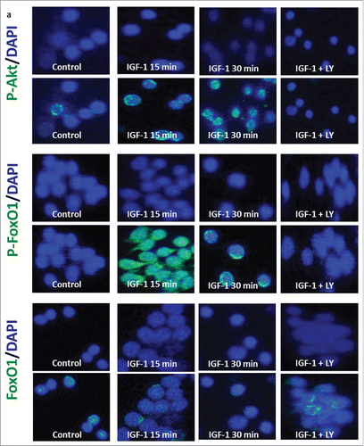 Figure 3. IGF-1 induces p-Akt and p-FoxO1 expression in human CD3-activated T cells. Activated T cells were treated with IGF-1 (0.001 µM) in the absence or presence of the PI3K inhibitor LY294002 for different time points and analyzed by immunofluorescence staining. Merged confocal microscopic images show p-Akt, p-FoxO1, FoxO1 (FITC) (pseudo-colored in green) and DAPI (pseudo-colored in blue) upon stimulation with IGF-1 (0.001 µM) for 15 and 30 minutes.