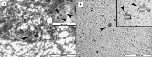Figure 8. A. Negative stain transmission electron microscope (TEM) images of SARS-CoV-2 virus particles in a Vero cell vesicle at different magnifications. B. TEM images of oval-shaped particles with diameters of 90–110 nm of the virus after the final purification step at different magnifications.