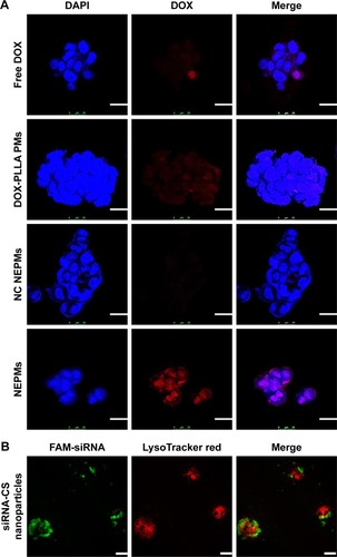 Figure 6 Cellular internalization of NEPMs.Notes: (A) Fluorescence visualization of DOX representing its intracellular accumulation after the treatment of H69AR cancer cells with various constructs. Blue: DAPI stained nucleus; red: DOX. (B) CLSM images of H69AR cancer cells treated with siRNA-CS nanoparticles. Green: FAM-siRNA; red: LysoTracker Red stained lysosome (scale bar, 25 µm).Abbreviations: CLSM, confocal laser scanning microscope; DAPI, 4′6-diamidino-2-phenylindole; DOX, doxorubicin hydrochloride; NC, negative control; FAM-siRNA, FAM-labeled siRNA; NEPMs, nano-embedded porous microparticles; PM, porous microparticle; siRNA-CS, short-interfering RNA-loaded CS.