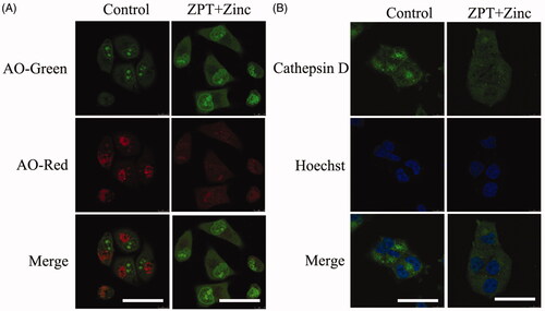 Figure 4. The effects of ZPT combined with Zinc on lysosomal membrane permeability and cathepsin D. (A) Representative images of acridine orange translocation to illustrate the change of lysosomal membrane stability after exposing in 0.35 μM ZPT and 20 μM Zinc for 4 h in SKOV3/DDP cells. (B) Representative images of cathepsin D translocation from lysosomes into the cytoplasm after 8 h treatment of 0.35 μM ZPT and 20 μM Zinc in SKOV3/DDP. Bar = 40 μm.