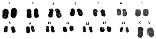 Figure 5. Karyotype of Arthrosphaera magna (2n = 30).