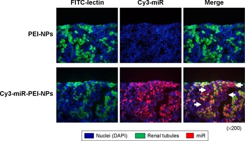 Figure 1 Distribution of microRNA (miR) with polyethylenimine nanoparticles (PEI-NPs) in obstructed kidneys.Notes: miR (red) intravenously injected along with PEI-NPs were observed in renal tubules (green) and in interstitial fibrous areas of obstructed kidneys, in which renal tubular cells do not have a regular form (arrow).Abbreviations: DAPI, 4′,6-diamidino-2-phenylindole; FITC, fluorescein isothiocyanate.