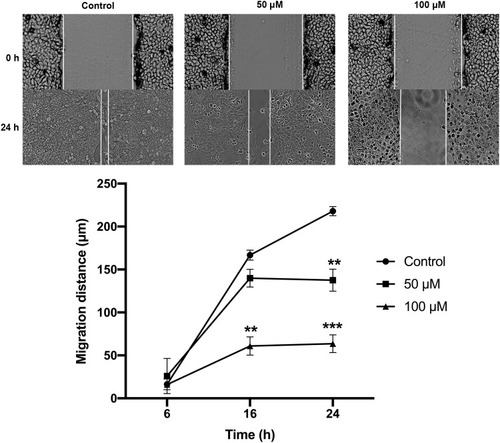 Figure 4 The effect of curcumin on TC cell migration. The CAL 27 cells were treated with curcumin at indicated concentrations, cell migration was studied using scratch wound assay. **P < 0.01 and ***P < 0.001, two-way ANOVA.