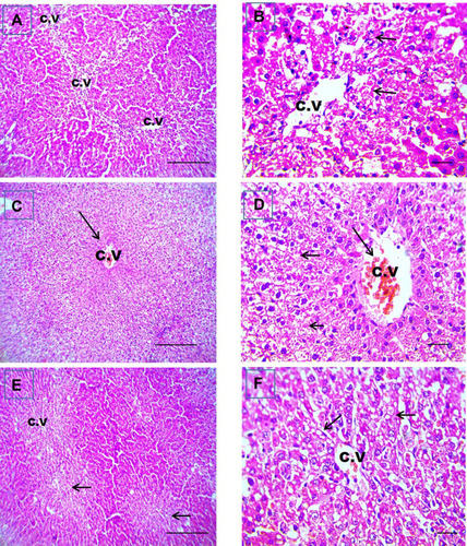 Figure 6 GLM alleviates liver injury in rat liver sections stained with hematoxylin-eosin. Representative microscopic pictures of liver sections showing centrilobular vacuolar degeneration of hepatocytes (short black arrows) with well-organized radially arranged hepatic cords in i.p.-treated group (A and B), congestion of CV (long black arrow), diffuse hydropic degeneration in hepatocytes (short black arrows) from EOD group (C and D). Centrilobular vacuolar degeneration of hepatocytes (short black arrows) (E and F) of daily group. H&E, (A, C, and E) X: 100 bar100 and (B, D, and F) X: 400 bar 50. i.p, Intraperitoneal group.