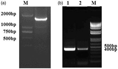 Figure 3. Representative gel photograph of PCR-amplified fragments. (a) Representative gel photograph of PCR-amplified pADRP gene 5′ flanking sequence. (b) Representative gel photograph of BSP analyses using bisulphite-treated DNA. 1: LEAN group; 2: FAT group.