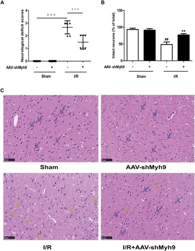Figure 3 NMMHC IIA inhibition via the AAV vector improves cerebral ischemia-reperfusion injury after MCAO/R. (A) Neurological deficit scores in different groups. Results are expressed as the mean±SD, n=6. ###P<0.001 vs sham group; ***P<0.001 vs model group. (B) Statistical analysis of intact neurons in the ischemic region. Results are expressed as the mean±SD, n=3. ##P<0.01 vs sham group; **P<0.01 vs model group. (C) HE staining showing the morphological characteristics of mouse brains upon MCAO/R. Shrunken neurons with pyknotic nuclei are indicated with yellow arrows while intact neurons are indicated with blue arrows. Bar: 50 µm.