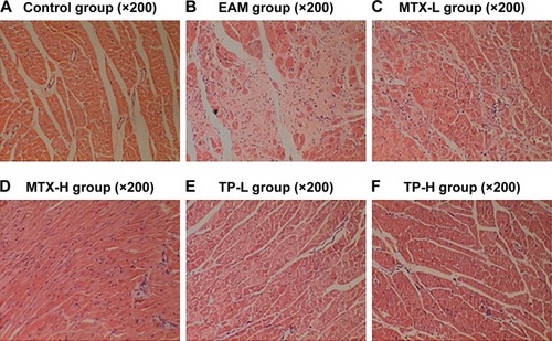 Figure 4 HE of myocardium in rats for each group.Notes: (A) In the control group, the myocardial cells were arranged in an orderly fashion and had no inflammation infiltration. (B) In the EAM group, the myocardial cells became sparse, with infiltrated inflammation. The proliferation of myocardial interstitial collagen fibrosis was also obvious. (C–F) The inflammation infiltration of the heart decreased and the proliferation of myocardial interstitial collagen fibrosis also became less.Abbreviations: EAM, autoimmune myocarditis; H, high dose; L, low dose; MTX, methotrexate; TP, triptolide.