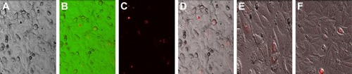 Figure 6 Light and fluorescence microscopy images of quantum dot (QD) labeled InP:ZnS QD-NPs in the MCF-7 cells.Notes: (A) Untreated control cells. (B–D) 20× images of the cells after incubation with InP:ZnS QD-NPs for 4 hours. (E, F) Higher magnification of treated cells 40×.Abbreviation: NPs, nanoparticles.