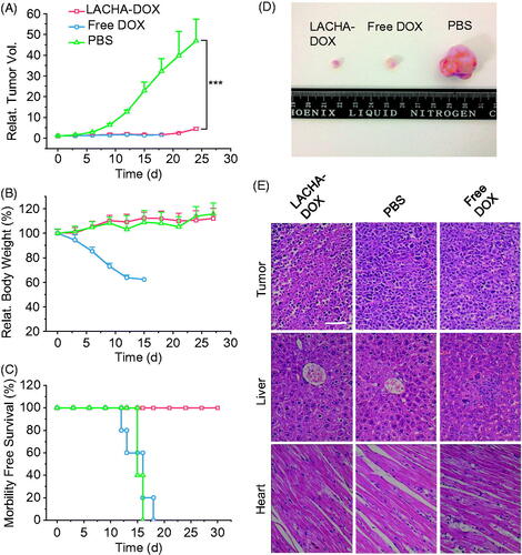 Figure 5. In vivo antitumor effects of LACHA-DOX in AML-2 human acute myeloid leukemia-bearing nude mice. Inhibition of tumor growth (A), body weight changes (B), and survival rates (C) of mice treated with LACHA-DOX, free DOX and PBS, respectively. The drugs were administrated on day 0, 3, 6, 9, 12 and 15 (dosage: 7.5 mg DOX equiv./kg) (n = 6). ***p < .001 (Student’s t test); Photos of typical tumor blocks (D), and H&E-staining of tumor, liver, and heart sections (E) isolated from different treatment groups on day 15. The scale bar represents 50 μm.