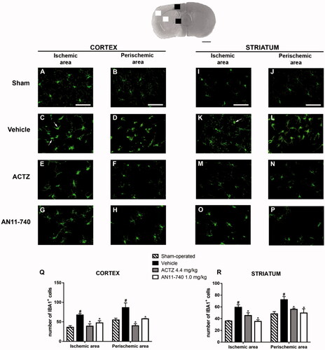 Figure 7. Effect of sub-chronic treatment with ACTZ and AN11-740 on microglia activation in cortex and striatum 24 h after pMCAo. Upper part: Representative photomicrograph of a coronal section (at Bregma = 0Citation36) showing the ischaemic area in a vehicle-treated rat. The two white and black squares indicate regions within the ischaemic area and within the perischemic area, respectively, where photomicrographs were captured. Scale bar = 2 mm. (A–P) Representative microphotographs of microglia (green) in cortical ischaemic and perischemic areas and in striatal ischaemic and perischemic areas of sham-operated (A, B; I, J, n = 3), vehicle- (C, D; K, L, n = 3) ACTZ- (E, F; M, N, n = 4) and AN11-740- (G, H; O, P, n = 3) treated rats. Scale bar = 50 µm. (Q, R) Quantitative analysis of IBA1+ cells in cortical and striatal ischaemic and perischemic areas, bar graphs represent mean ± SEM of the number of microglia cells per optical field (20×). One-way ANOVA followed by Newman–Keuls post hoc test: #at least p < 0.05 vehicle-treated vs. sham-operated rats; *at least p < 0.05 ACTZ- and AN11-740- vs. vehicle-treated rats.