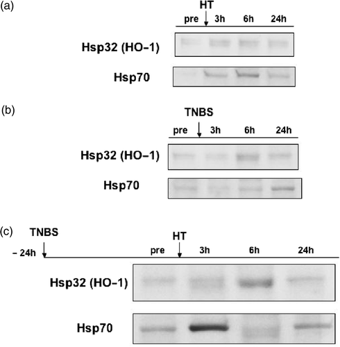 Figure 6. Induction of heat shock proteins in rat colon. (a) Hsp32 and Hsp70 inductions after HT. (b) Hsp32 and Hsp70 inductions after the enema of TNBS. (c) Enhanced effect of HT on the TNBS-induced Hsp32 and Hsp70.