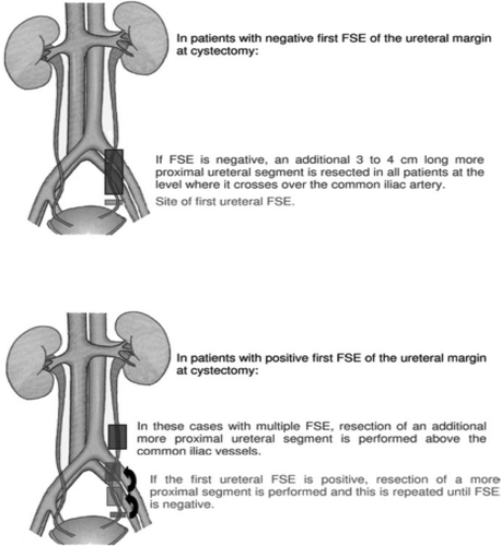 Figure 2. Template of how to perform a frozen-section examination [Citation15].