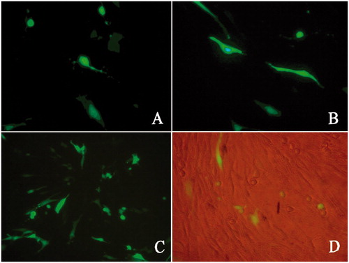 Figure 3. Fluorescence photomicrographs of green fluorescent protein expression of c-Myc-siRNA3-pDNAs after 24 h transfection: (A) c-Myc-siRNA1-pDNAs, (B) c-Myc-siRNA2-pDNAs, (C) c-Myc-siRNA3-pDNAs, and (D) c-Myc-siRNA3-pDNAs (detected with fluorescent and white light overlap).