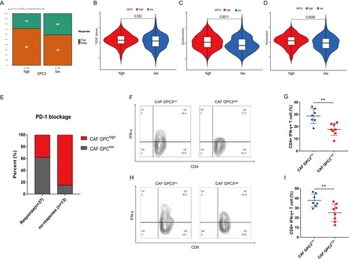 Figure 5. GC with GPC3high CAFs is correlated with lower response of PD-1 blockage therapy. (A) The likelihood of the clinical response to anti-PD-1 therapy for high and low GPC3 expression GC patients from the TCGA cohorts. True represents immunotherapy responders, while false represents immunotherapy nonresponders. (B–D) The violin plots present of TIDE value, immune dysfunction and immune exclusion in high and low GPC3 expression GC patients. (E) The relationship between different GPC3 expression in CAFs and the response ratio of anti-PD-1 therapy in GC patients. (F–I) The proportion of interferon (IFN)-γ-positive cells of CD4+ or CD8+ T cells in the tumours with different GPC3 expression in CAFs.