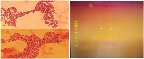 Figure 1. Leuconostoc mesenteroides isolates under microscope examination and PCR bands.